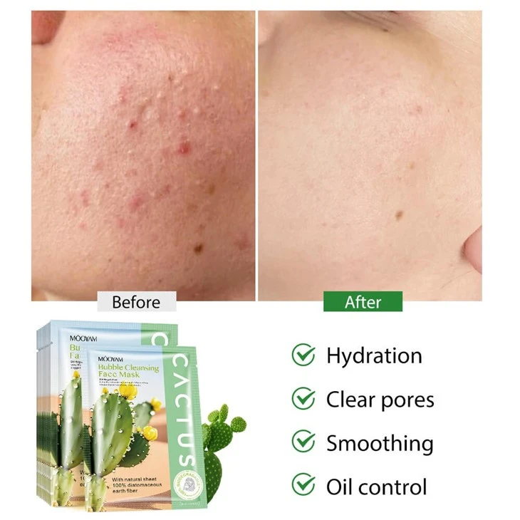 Deep Clean & Matte Skin? Try MOOYAM Bubble Mask